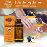 30ml Hot Sale Pure Plant Essential Oil Ginger